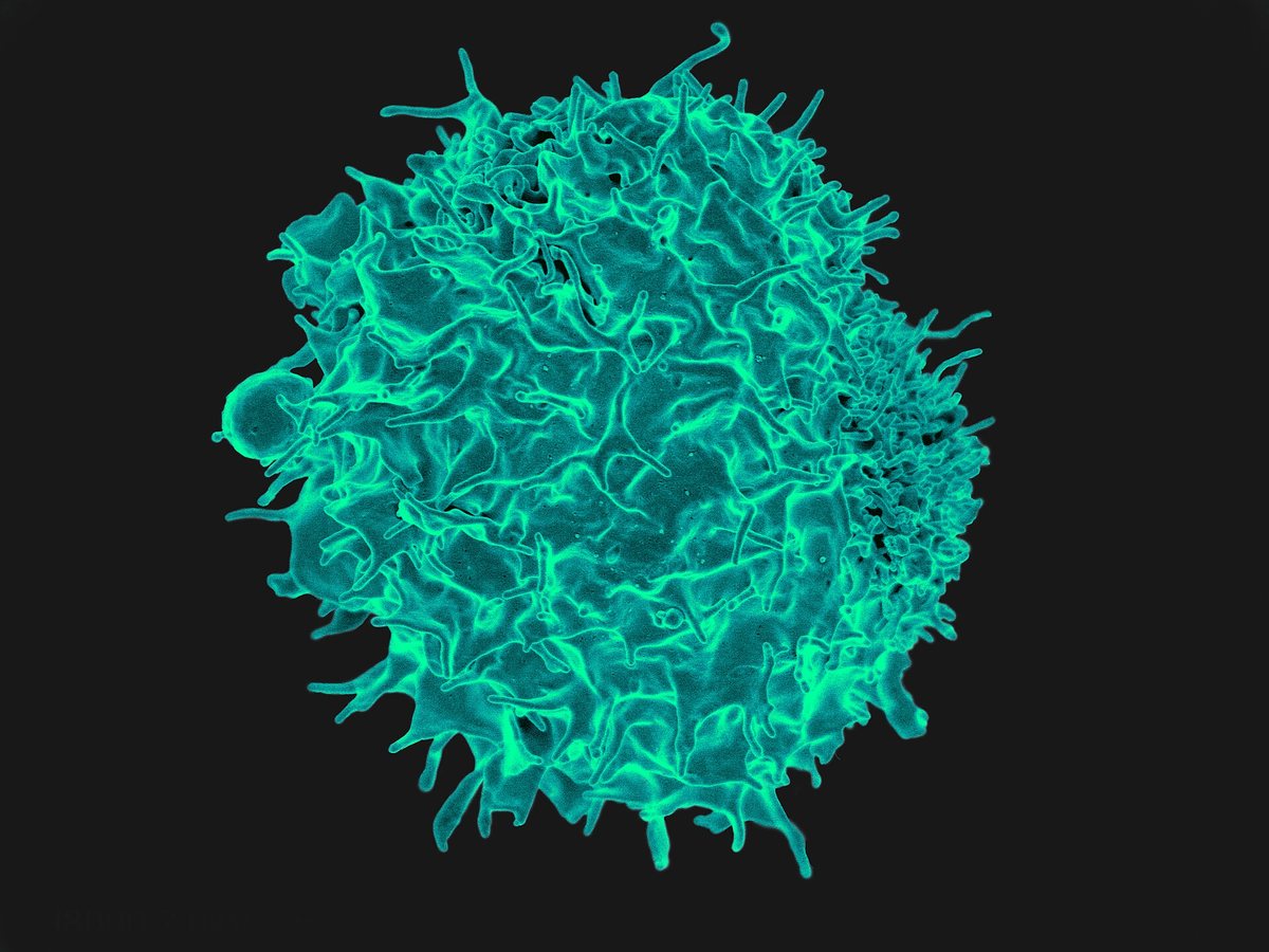 CAR-T Cells Engineered Inside Patients Show Early Promise in Autoimmune Disease