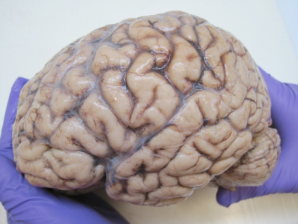 Stalled neurogenesis in hippocampus linked to major depression