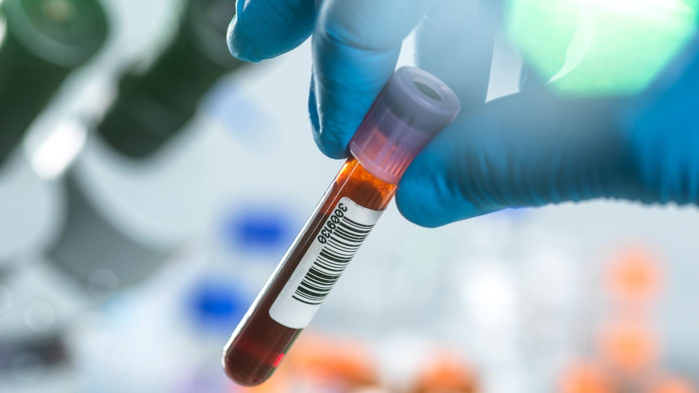 Blood Protein Signature May Predict Healthy Aging, Study Finds