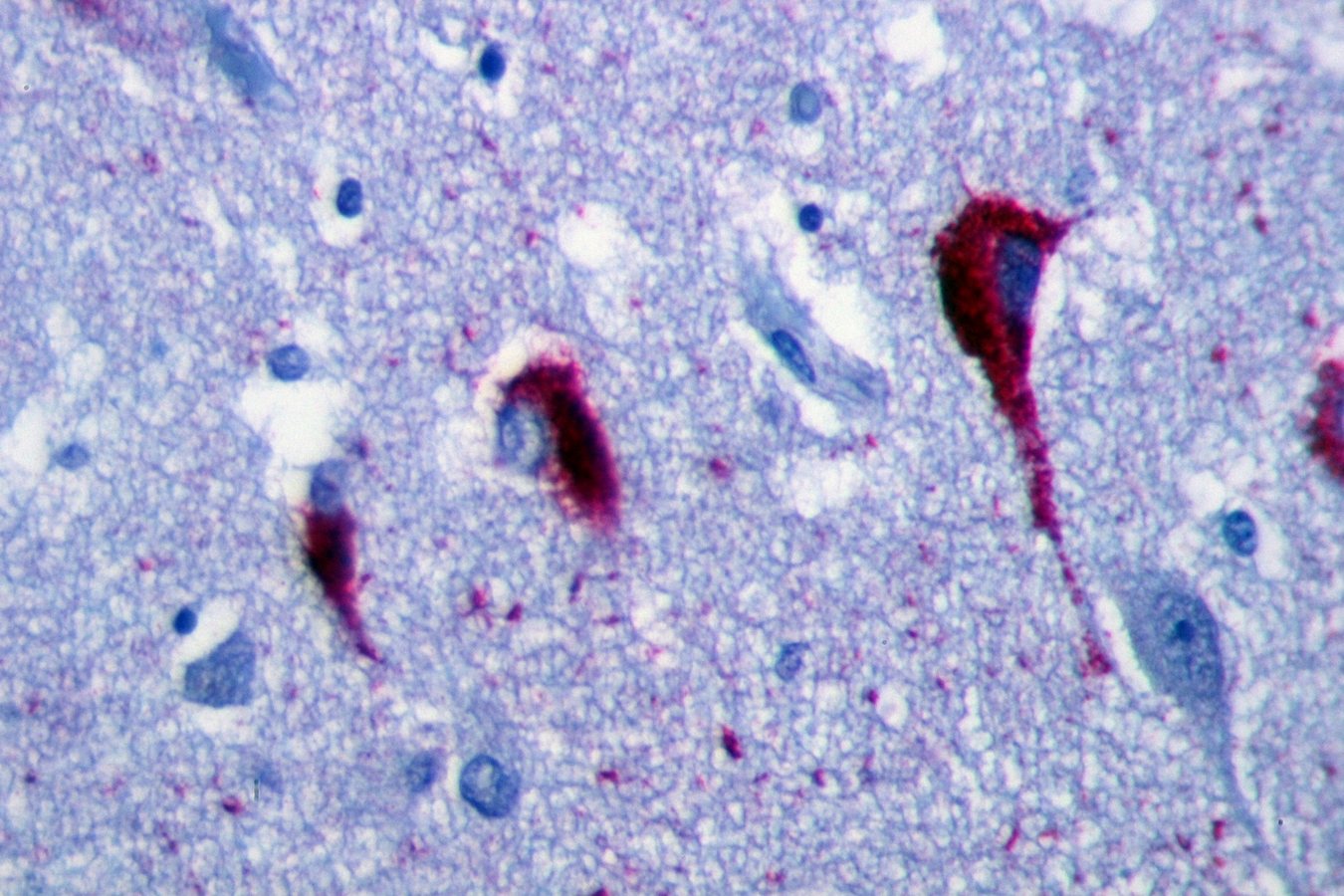Tau Protein May Damage Neurons Through a Mitochondrial Feedback Loop
