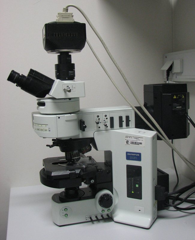 Disordered Tissue Geometry Around Tumors Found to Drive Cancer Spread