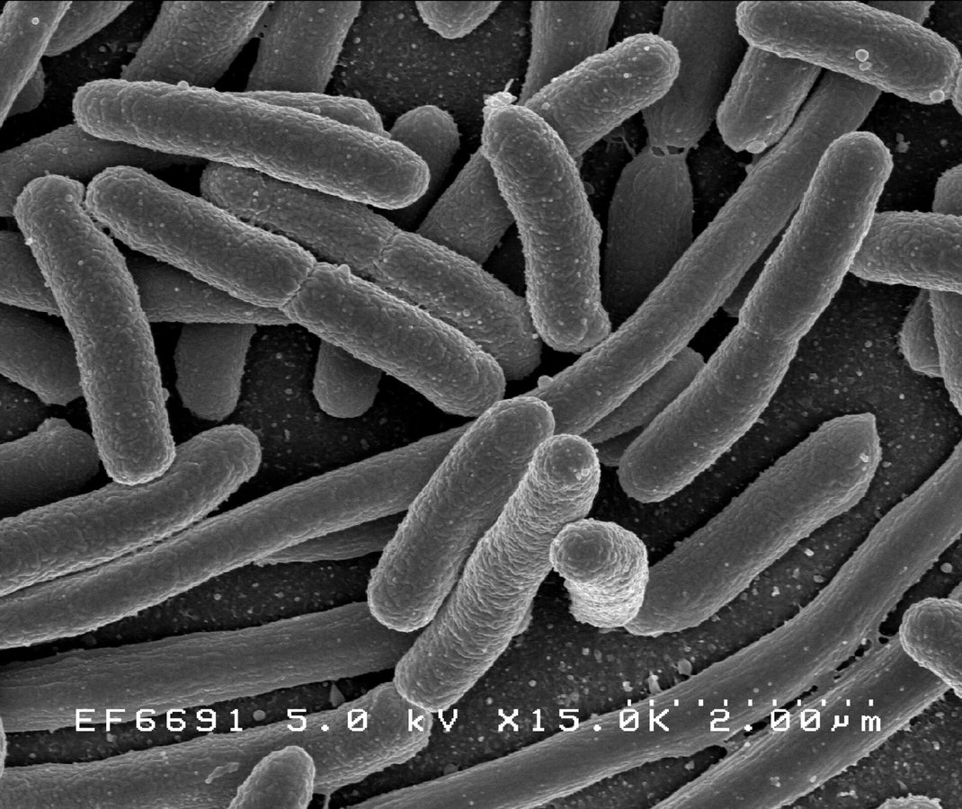 Gut Microbiome Tracks Inflammation Better Than Age in 1,199 Adults