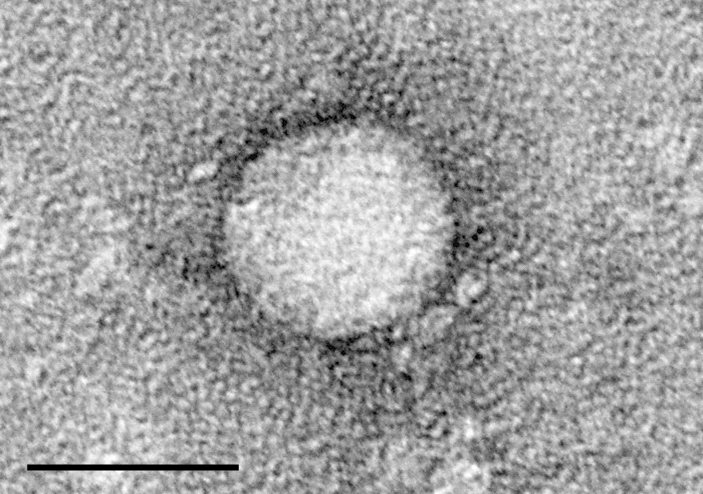Shorter Hepatitis C Regimens Seen as Key to Elimination Push