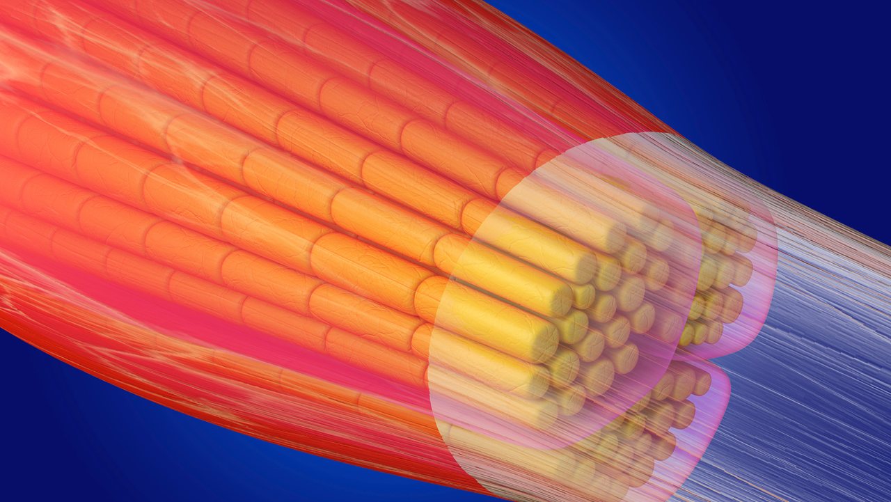 Study hints at possible clue to prevent muscle aging
