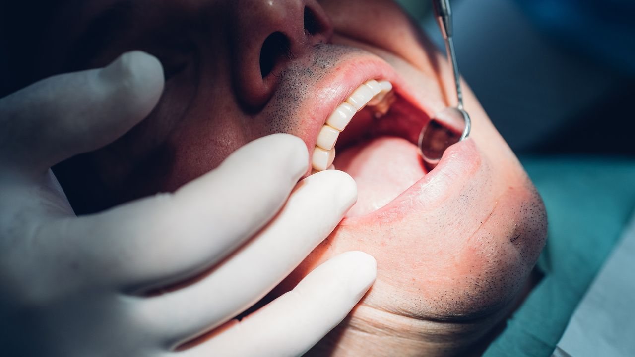 Gum disease bacteria may contribute to heart valve damage, early study finds