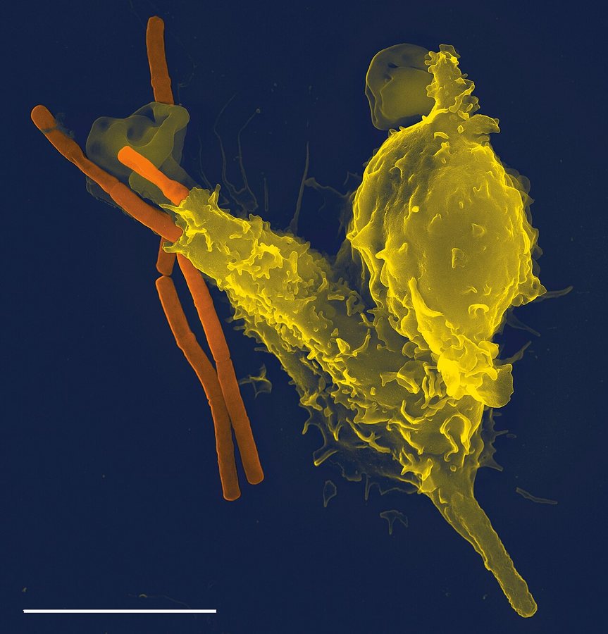 Researchers explore whether measuring immune health could reshape medical care