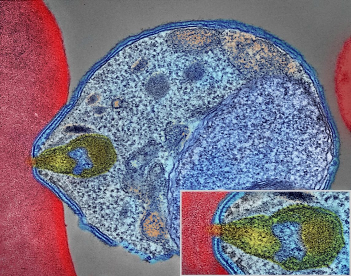 Global study finds antibiotic-resistant bacteria increasingly threaten children