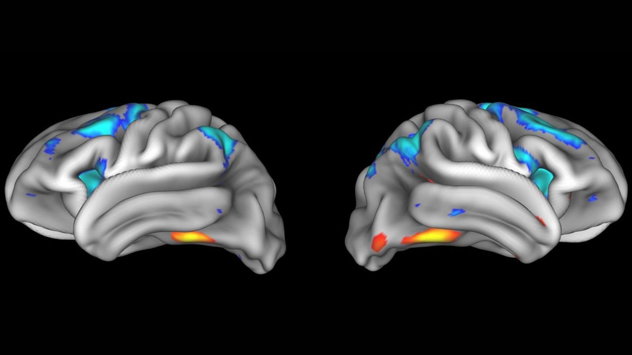 Neuroscience Studies Often Fail Replication Tests, Undermining Brain Research